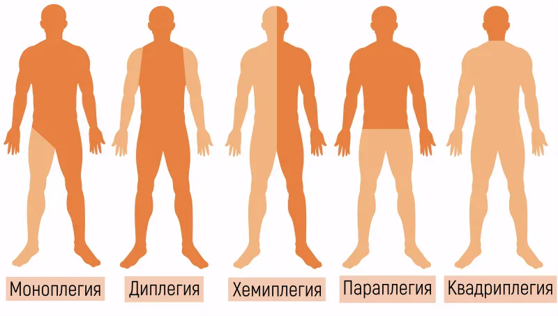 ����� ������������ ����������?