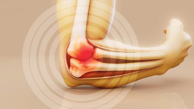 �������������� ��� ������� �� �����