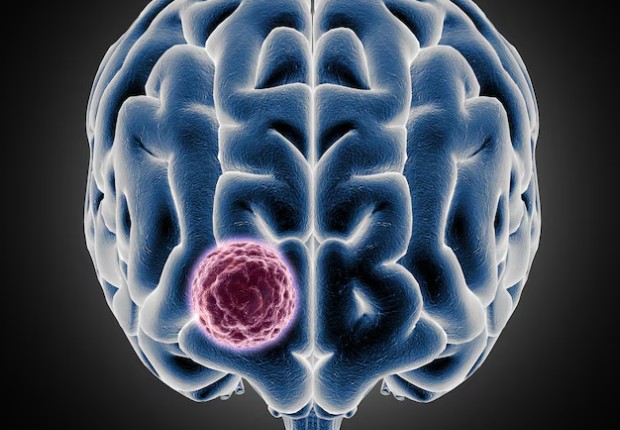 Патофизиология хамартом Патофизиология хамартом