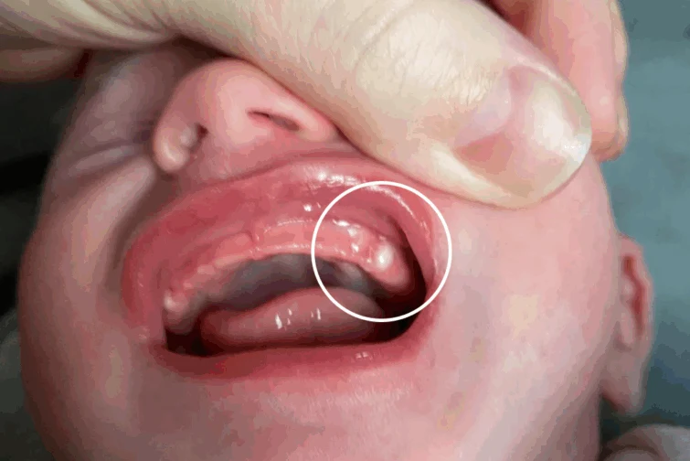 Перли на Епщайн Перли на Епщайн