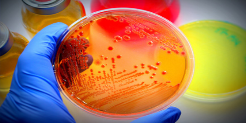E.coli petri