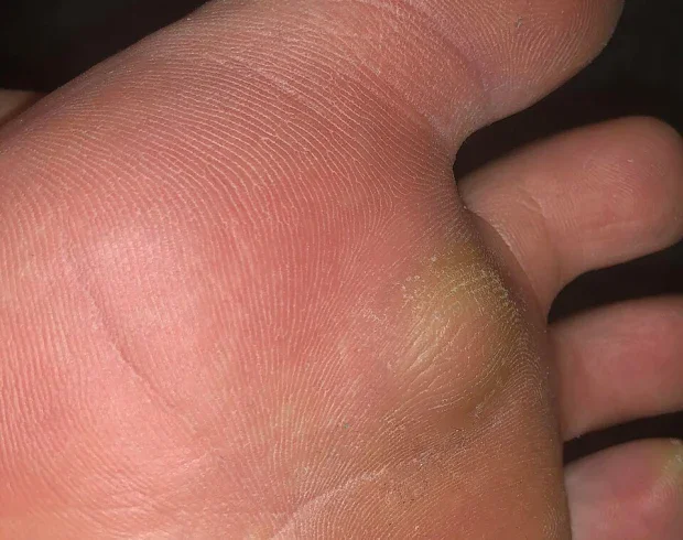 ��������� ����������� ��� 2-�� ����� �� ��������