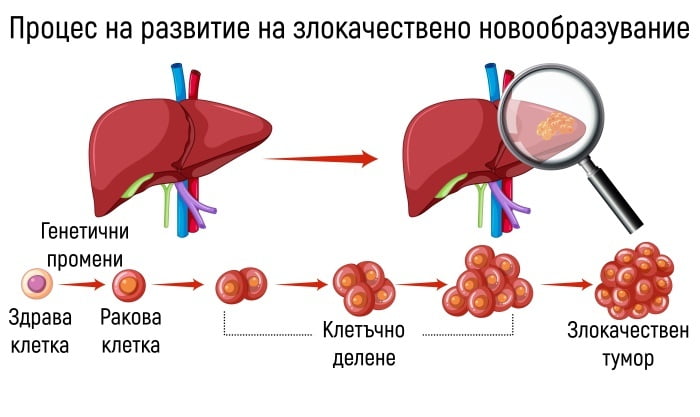 Развитие на рак Развитие на рак