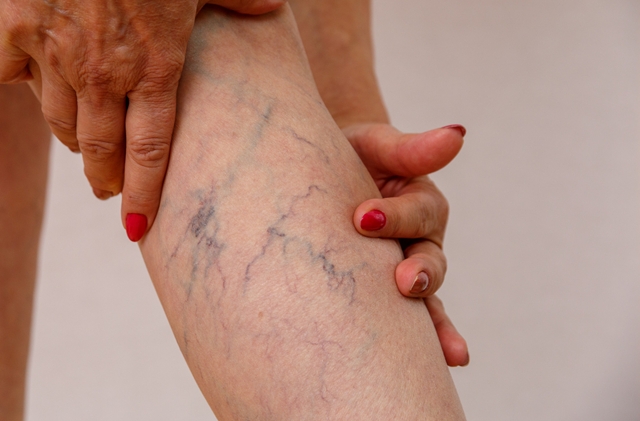 �������� ��� ����������� ����