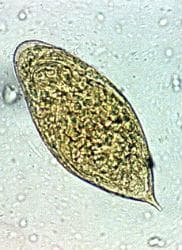 Schistosoma haematobium - 