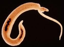 Schistosoma haematobium -  