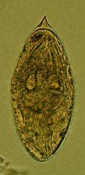 Schistosoma japonicum - 