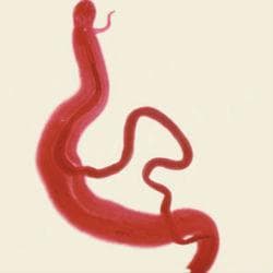 Schistosoma mansoni -  
