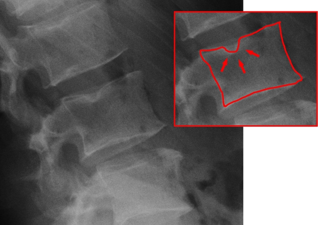 ����� �� �����- �������