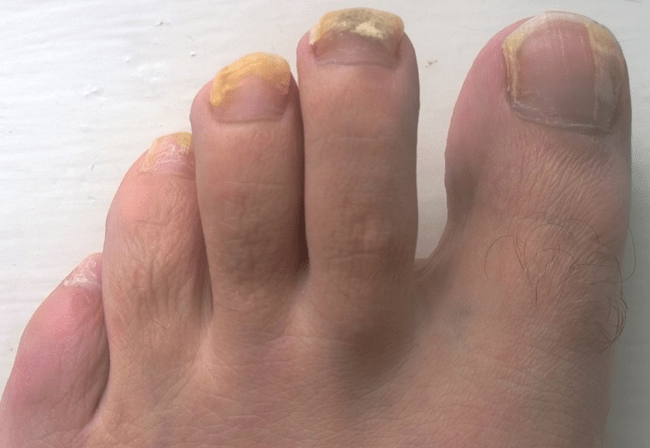 �������� ��� ����������� �� ����� 