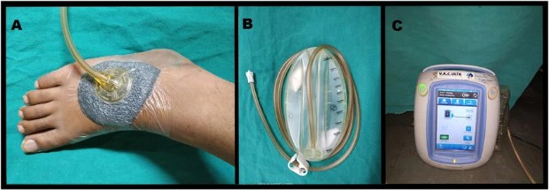 ������ ������� �� ��������� �� ����