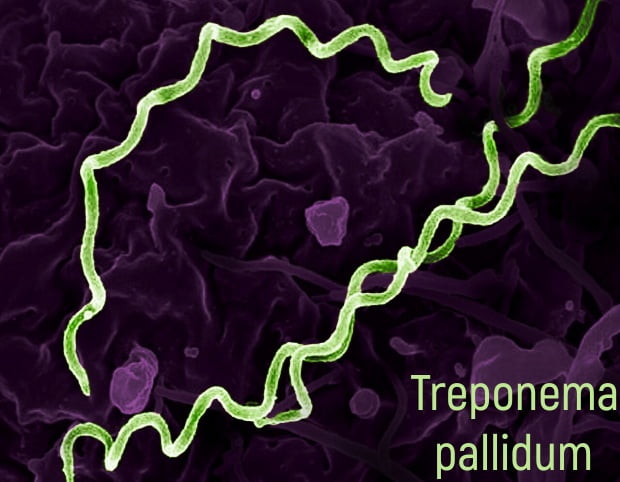 Treponema pallidum