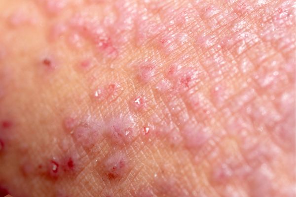 ����������� �� ������� �������� 