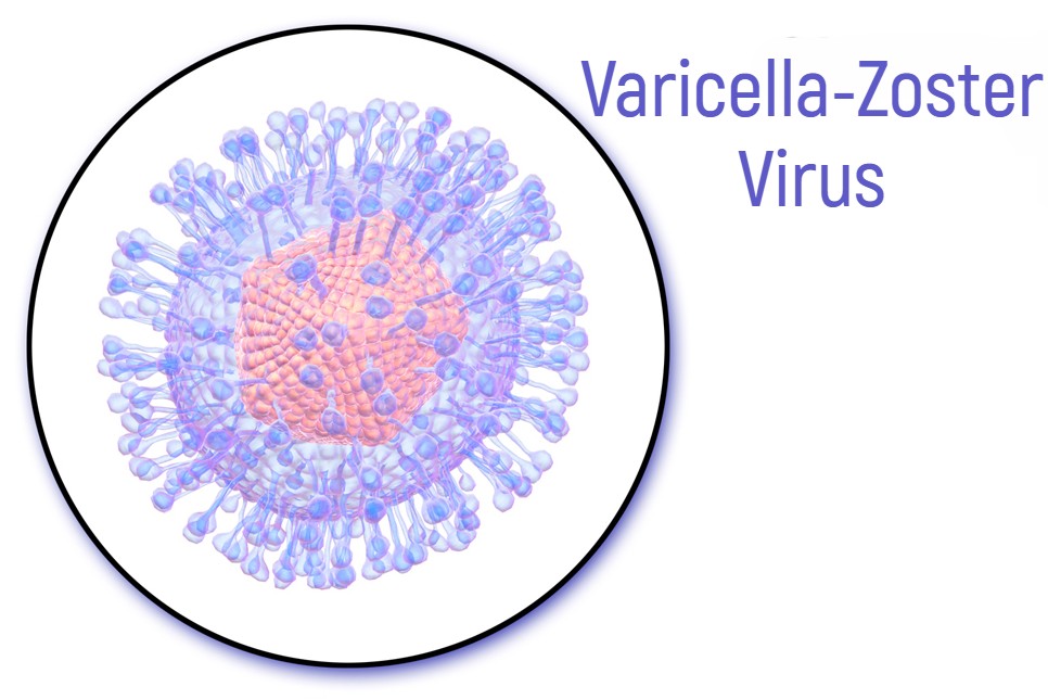 Varicella-Zoster Virus