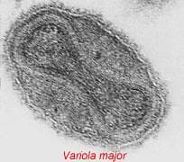 variola major