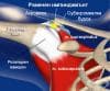 Раменен импинджмънт в спорта (Impingement Syndrome)