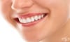 Рисковe, които крие избелването на зъбите в домашни условия