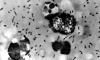  Yersinia pestis       