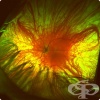 Изследване на ретината