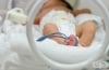 Обменно кръвопреливане при хемолитична болест на новороденото