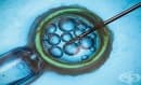 Специалисти препоръчват имплантирането само на една оплодена яйцеклетка при ин витро