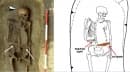 История на медицинските консумативи