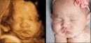 Очарователни снимки на бебета от ултразвук и след като се родят