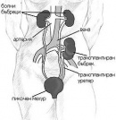 I82.3 ������� � �������� �� �������� ����