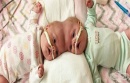 Американски хирурзи успешно разделиха сиамски близнаци със сраснали глави 