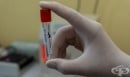 Нов диагностичен метод може да ускори тестовете за коронавирус и да улесни откриването на цистична фиброза 