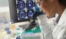 Откриха връзка между завишените стойности на желязо в мозъка и болестта на Алцхаймер