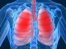 � ���� �������� ��������� ����� ���������� ��� CimaVax-����