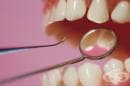 Соленият разтвор почиства добре зъбните протези