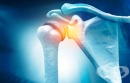 Екстракорпорална ударно-вълнова терапия – технологичният метод за лечение на замръзнало рамо