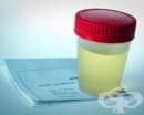 Тест за 17-хидроксикортикостероиди в урина
