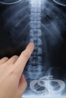 Рентгеново изследване на гръбначния стълб