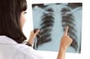 Рентгеново изследване (рентгенография) на гръден кош