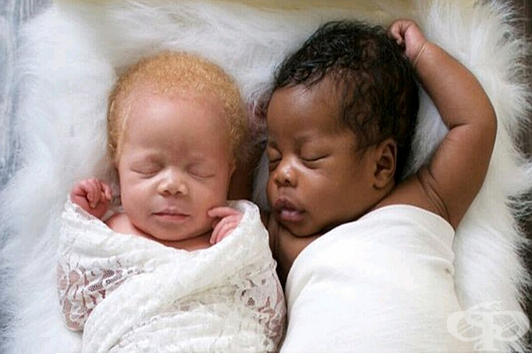 Фотографка ражда близнаци с различен цвят на кожата | Галерия Framar.bg