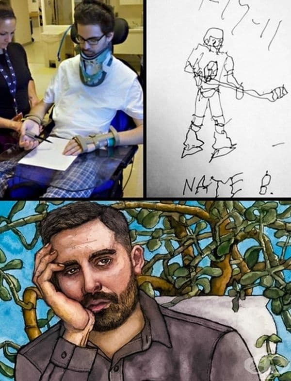 След травма момчето е започнало отначало да се учи да рисува. Това е неговия прогрес.