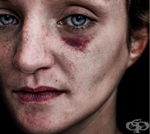 Фотограф улавя болката в сърцето на бездомни хора чрез тези уникални фотографии