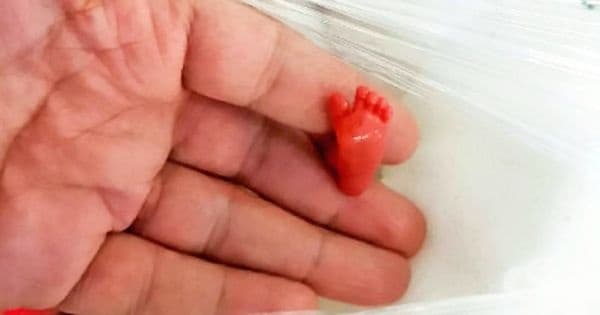 Бебе, което се ражда 12 седмици по-рано и успява да оцелее.
