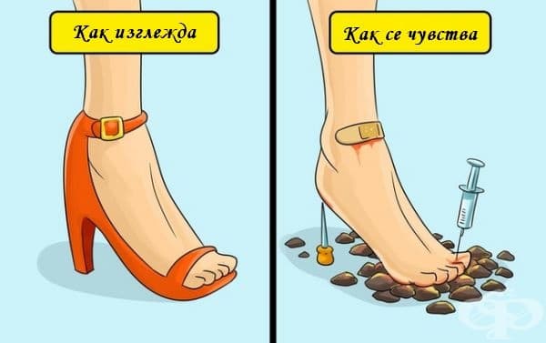 Красотата изисква жертви.