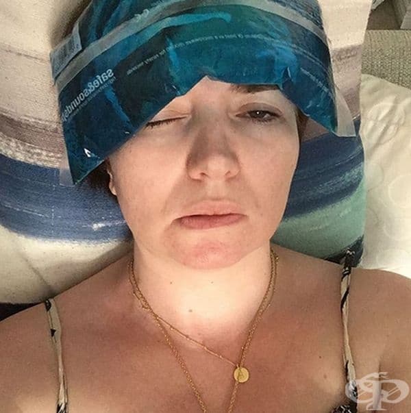 Тези снимки показват истинското лице на мигрената. Хората споделят какво чувстват и колко много се борят.