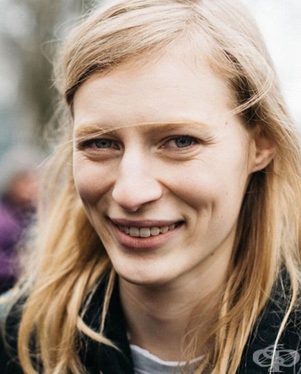Джулия Нобис. Много дами се притесняват от големия си нос, но не и австралийския модел Джулия Нобис. Нейна отличителна черта е самата гърбица на носа.