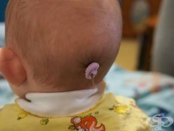 Първата й конска опашка.