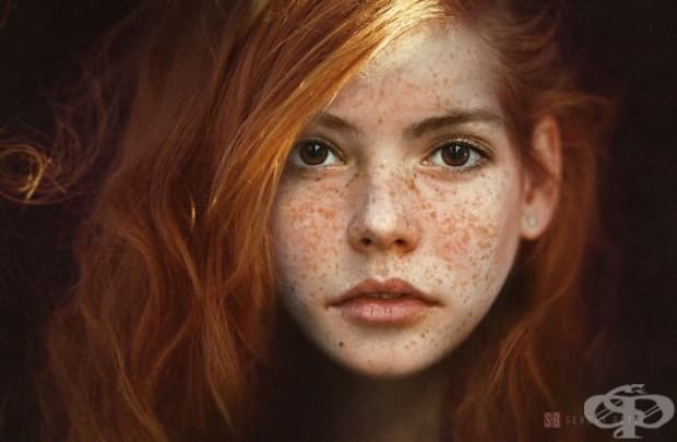15 хипнотизиращо красиви хора с лунички
