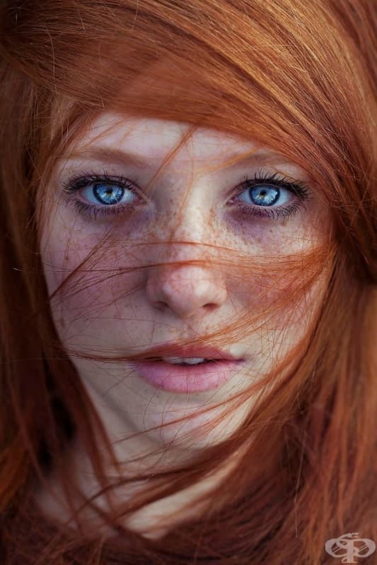 15 хипнотизиращо красиви хора с лунички