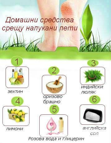 Топ 6 домашни средства срещу напукани пети