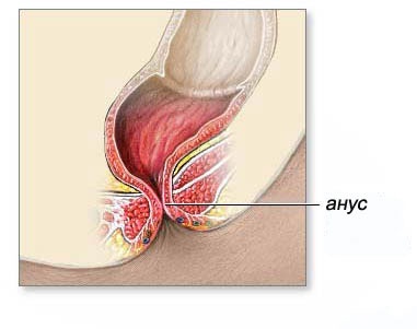 Отек ануса