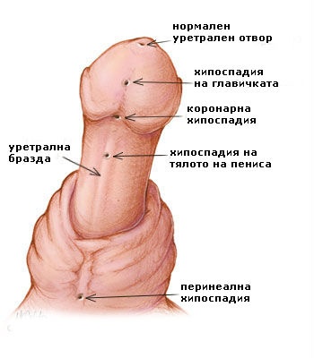 Папуа-Новая Гвинея + Путешествия